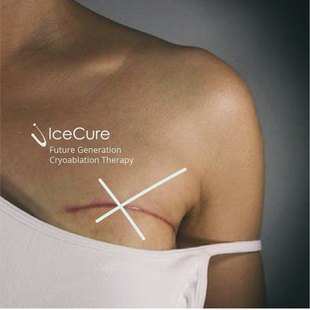 IceCure Branding NotfromHere-12